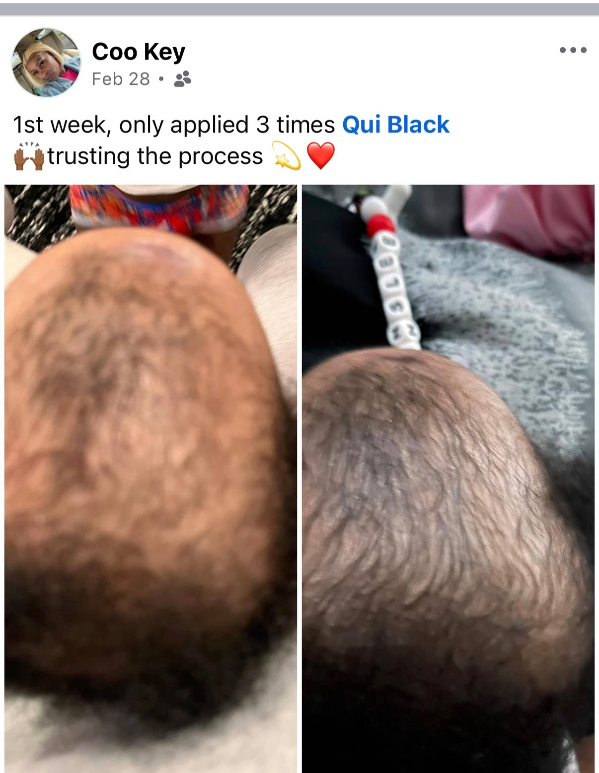Issa Loc Hair Growth Oil ( 2oz bottle )