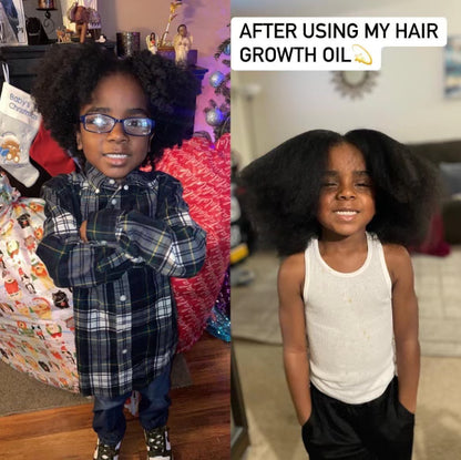 Issa Loc Hair Growth Oil ( 8.5 Oz )